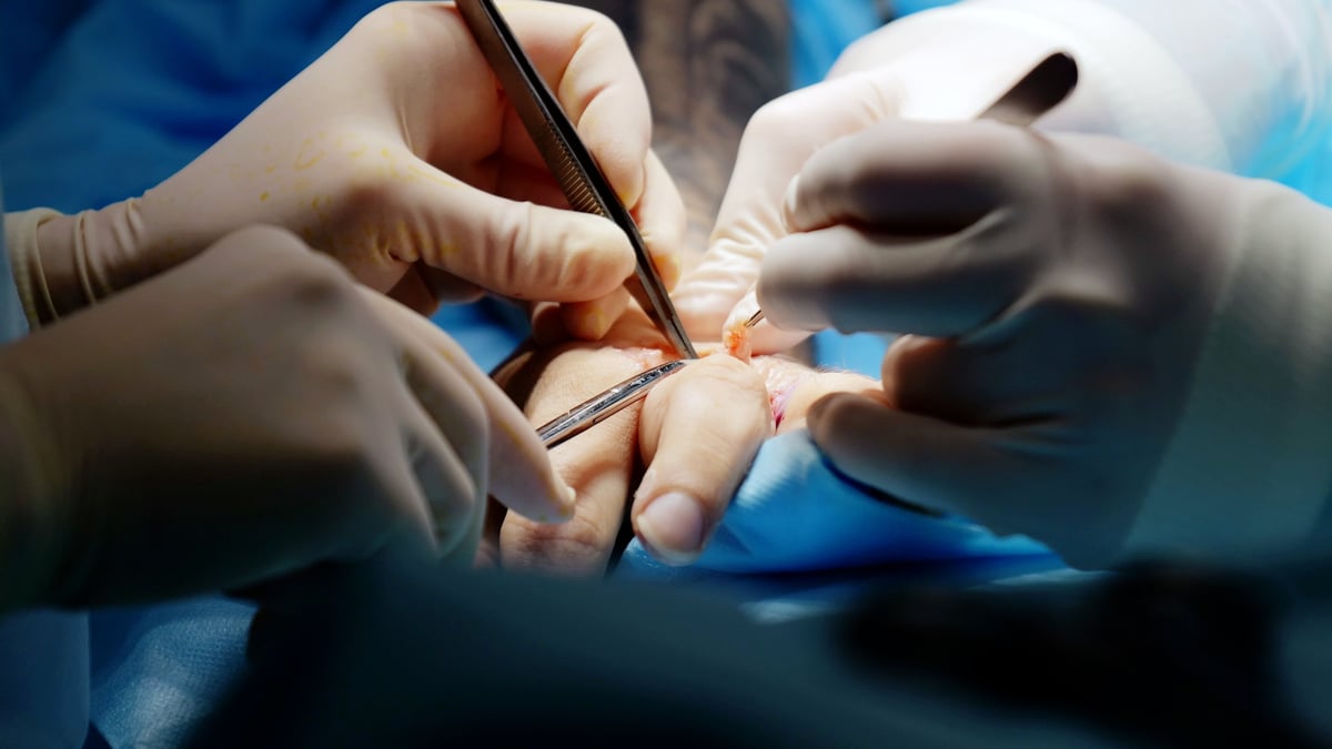 Surgeons carefully operating on a patient's hand using specialized tools in a sterile environment